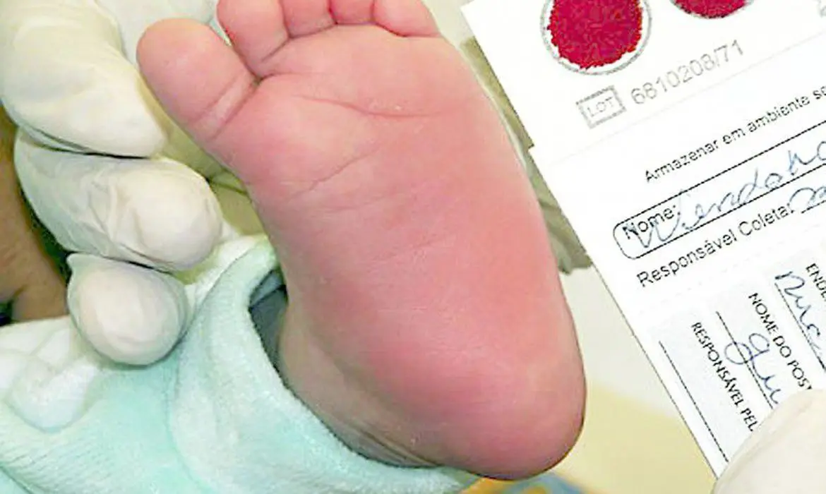 Variações do Teste do Pezinho podem identificar até 100 doenças raras
