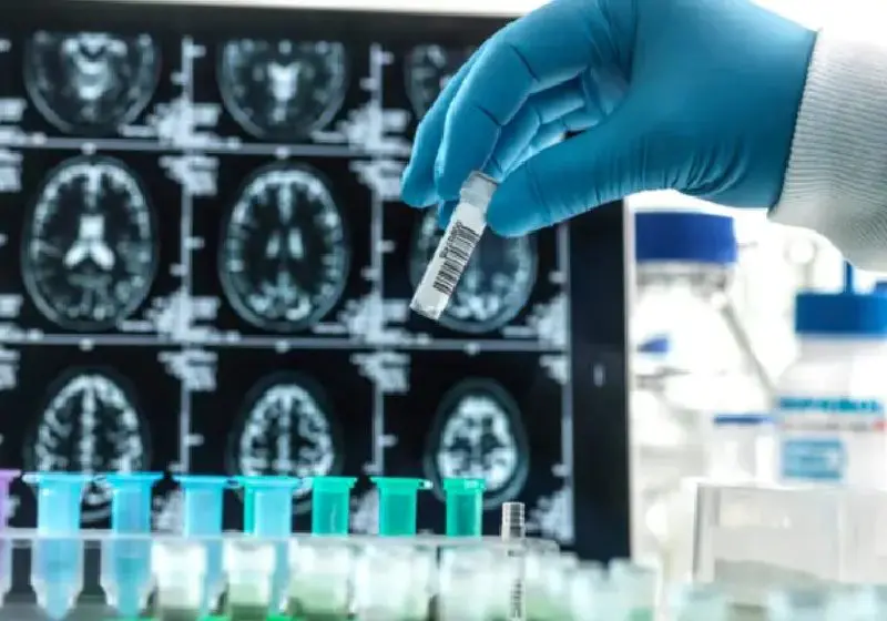 Alzheimer: novo remédio retarda declínio mental em 27%. ‘Mais encorajador até hoje’