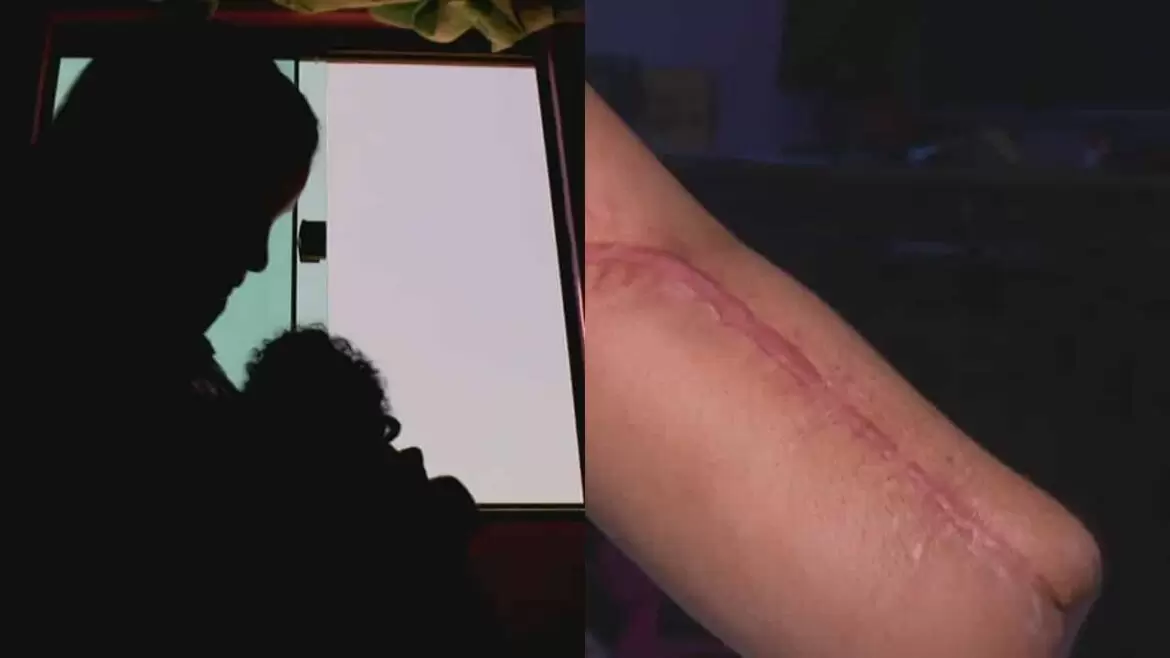 Mulher vai para hospital dar à luz e sai com a mão amputada