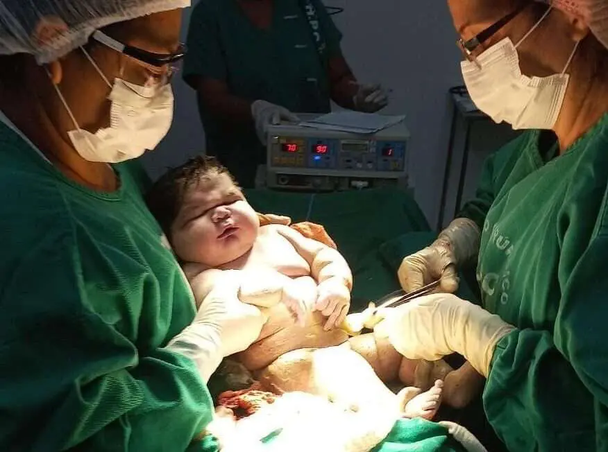 Maternidade de Parintins registra o nascimento do maior bebê do Amazonas