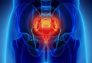 Cirurgia a laser é nova opção para tratar cisto pilonidal