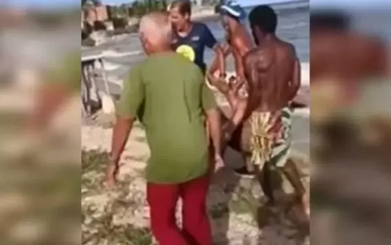 Surfista atacado por tubarão em Olinda está em estado grave