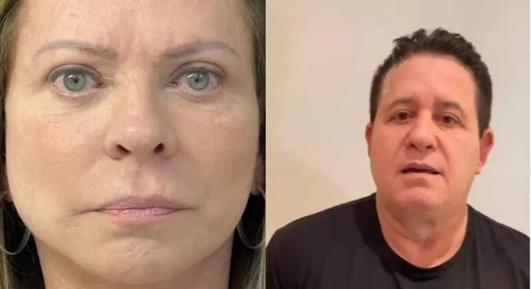 De Christina Rocha a Marrone: veja famosos que fizeram harmonização facial e não mudaram nada