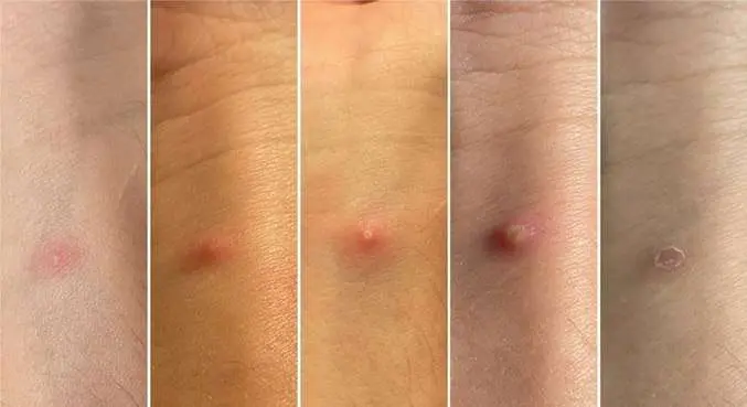 Doenças infecciosas transmitidas por animais se multiplicam pelo mundo