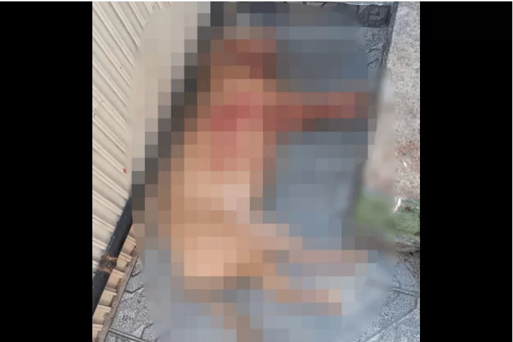 Compositor foi atacado por pitbull enquanto tentava fazer curativo no rabo do cão, diz polícia