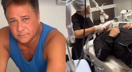 Leonardo faz procedimento estético na papada, e Poliana Rocha elogia: 'Já deu resultado
