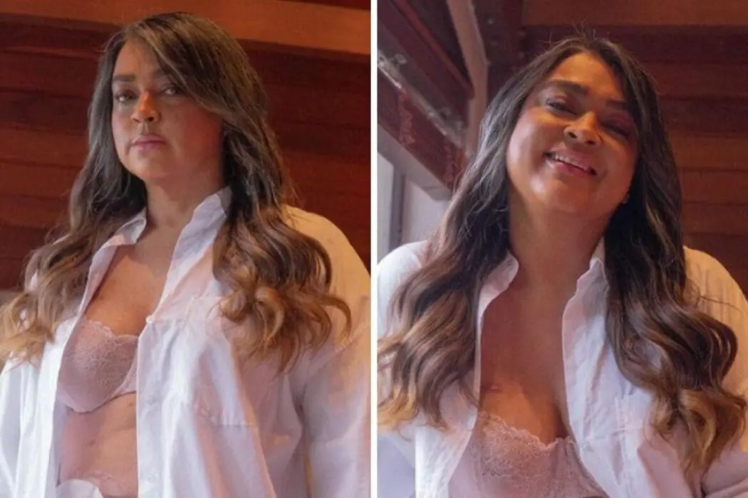Preta Gil posa com bolsa de ileostomia à mostra: 'Não tenho vergonha, pois salvou minha vida'