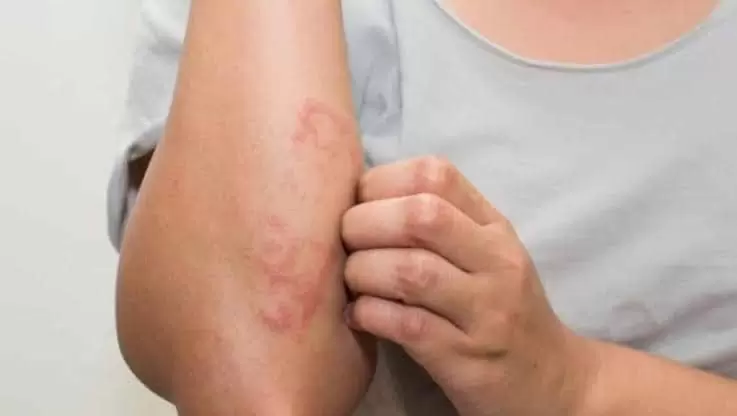 Hanseníase: pacientes contam histórias de preconceito e superação