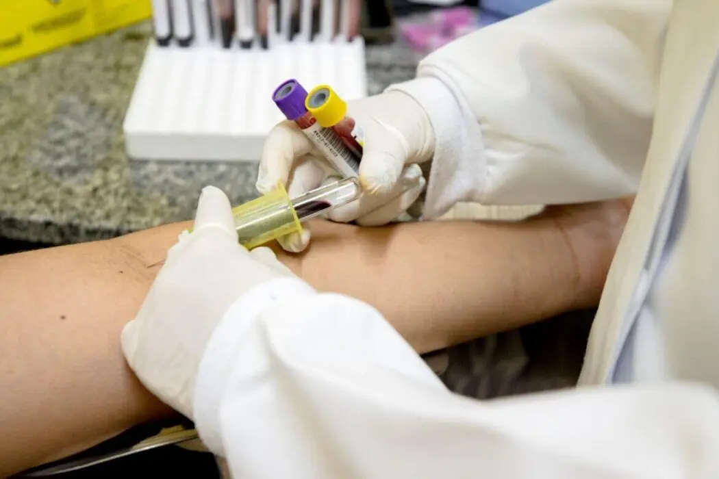 Prefeitura de Manaus abre campanha de mobilização contra a tuberculose nesta terça-feira (5)
