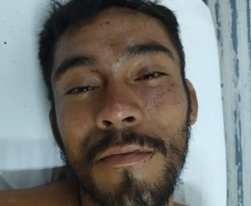 Hospital João Lúcio pede ajuda para encontrar familiares de paciente internado