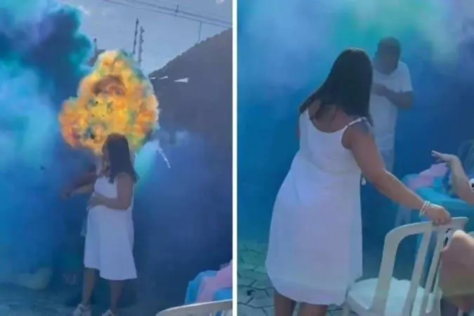 Chá revelação acaba em explosão e deixa pai ferido