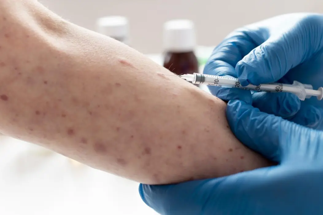 Mpox no Amazonas: caso único identificado em Parintins não é novo e diagnóstico já havia sido feito em Manaus