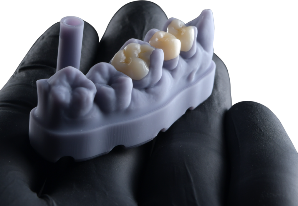 FGM Dental Group e dOne 3D apresentam a Voxelprint Ceramic