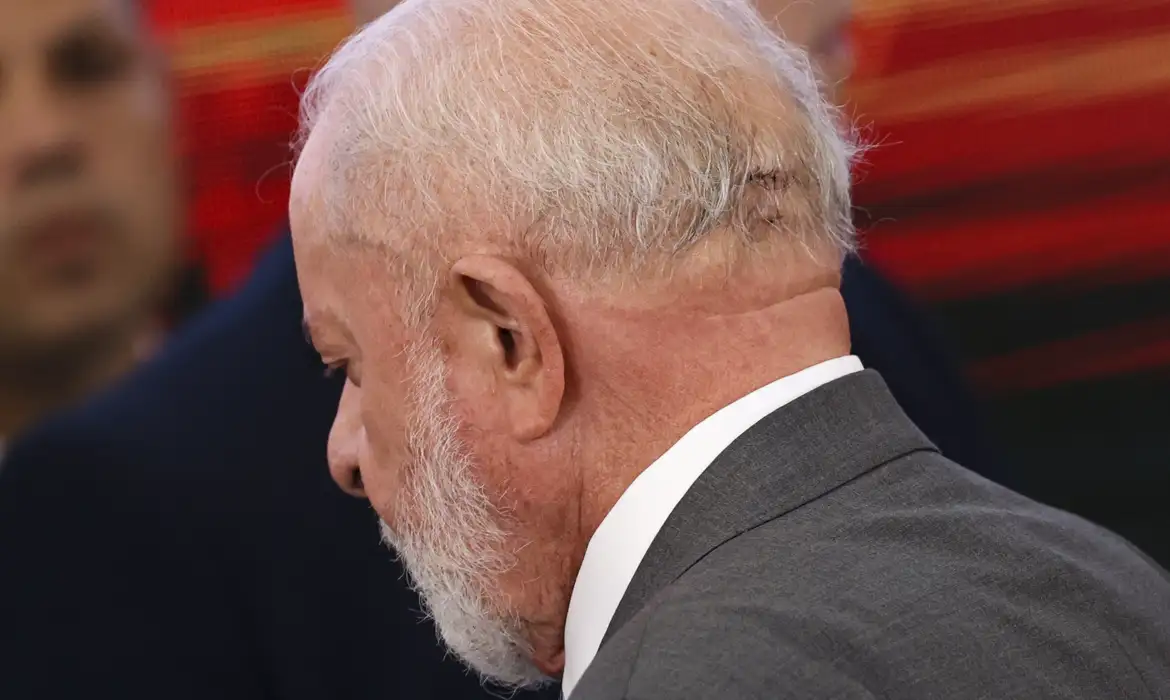 Lula fará novo procedimento nesta quinta para bloquear fluxo de sangue no crânio