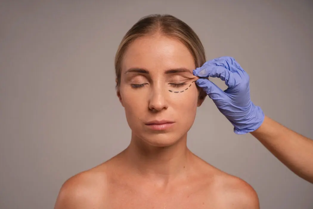 Cirurgia plástica ocular vai além da estética