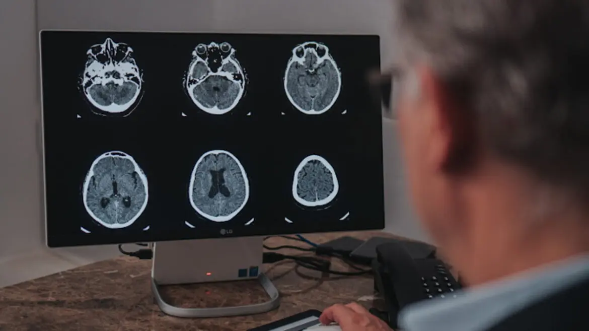 Setembro é o mês de conscientização do aneurisma cerebral
