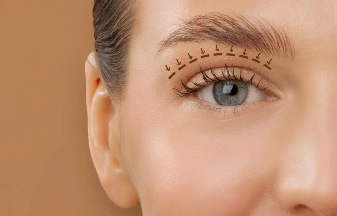 Blefaroplastia envolve função ocular além da estética