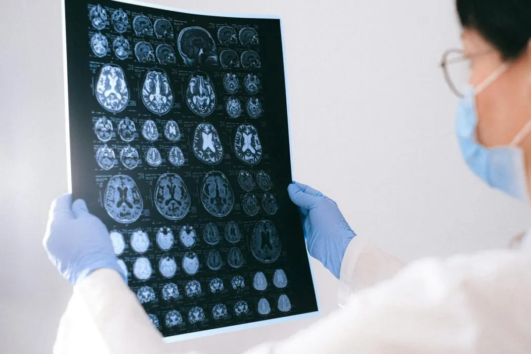BrainAge: tecnologia indica a idade cerebral