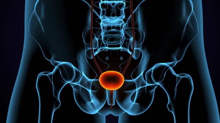 Urologista explica diferenças entre HPB e câncer de próstata