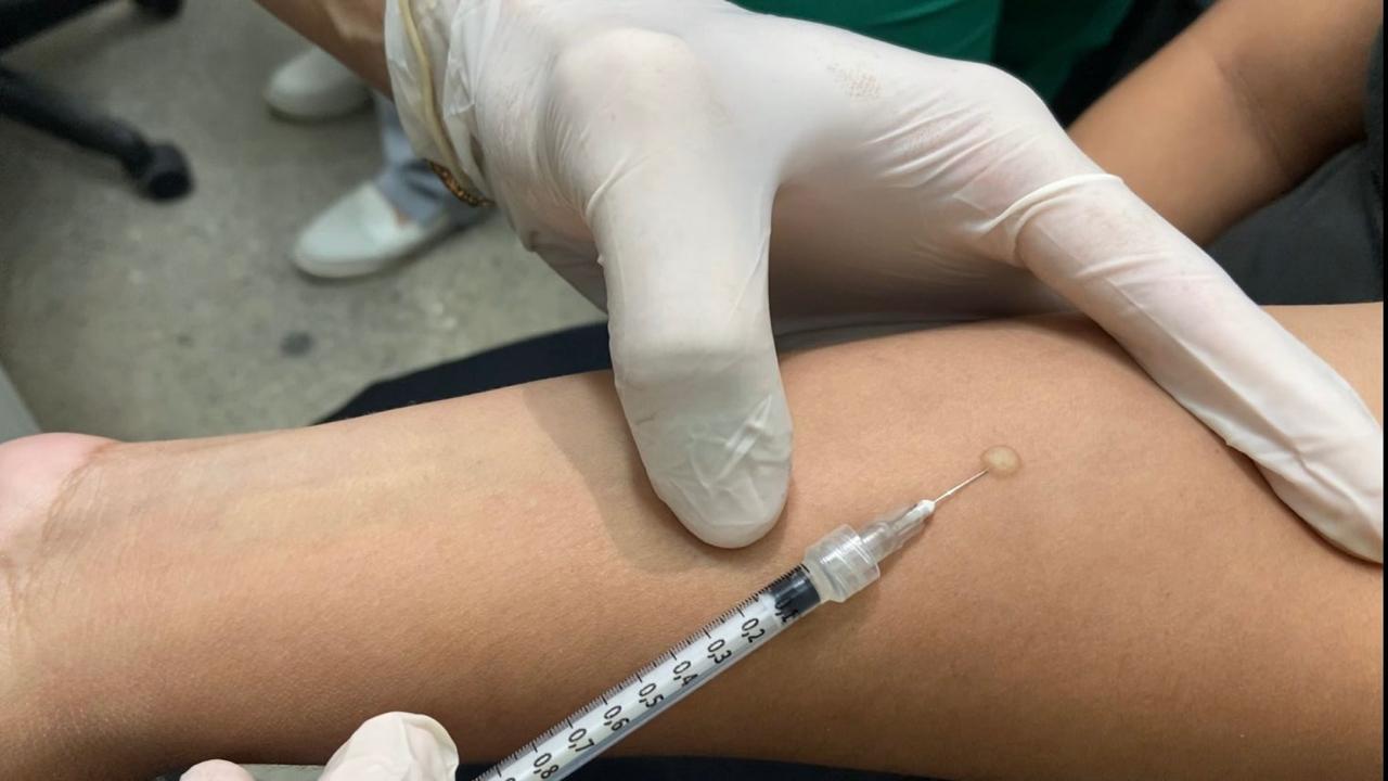 Semsa passa a oferecer teste tuberculínico em 55 unidades de saúde de Manaus