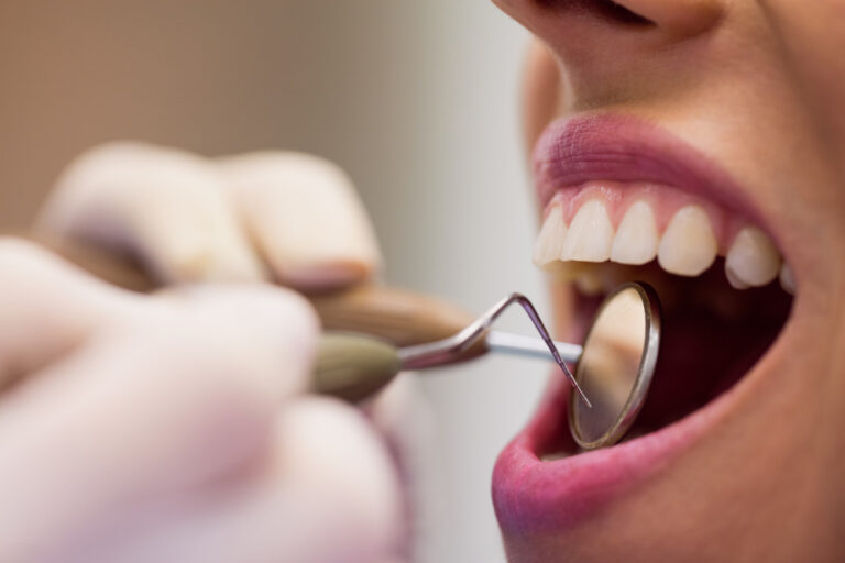 Sangramento na gengiva pede avaliação, alerta dentista